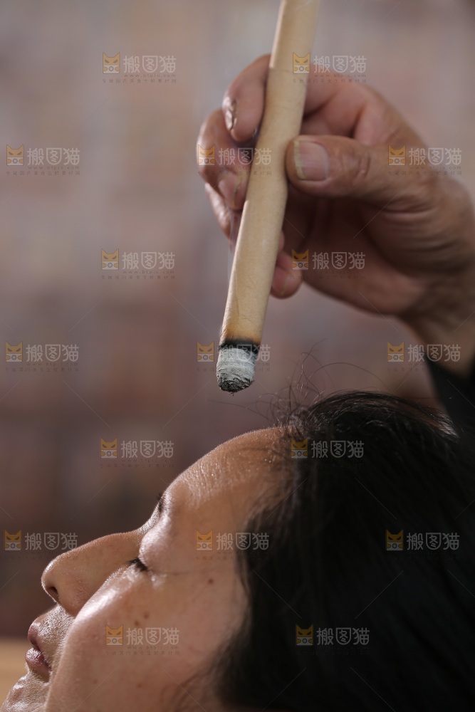 艾灸