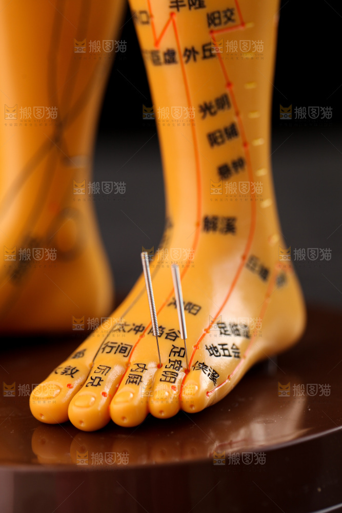 针灸