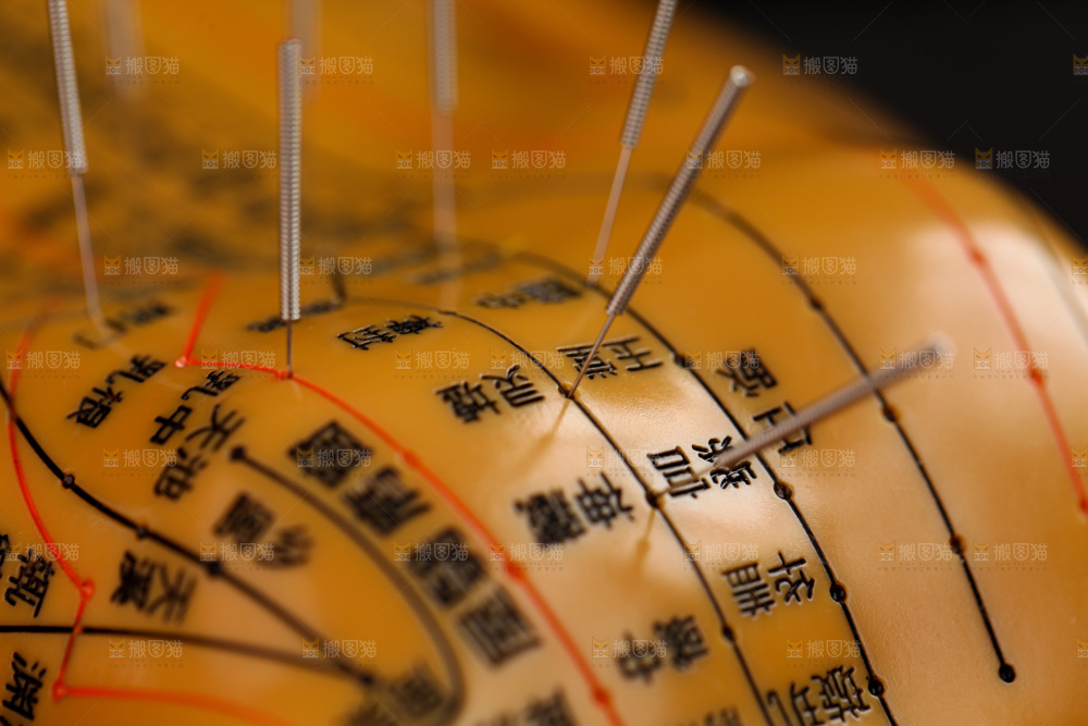 针灸