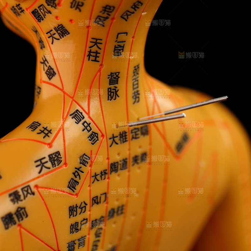 针灸