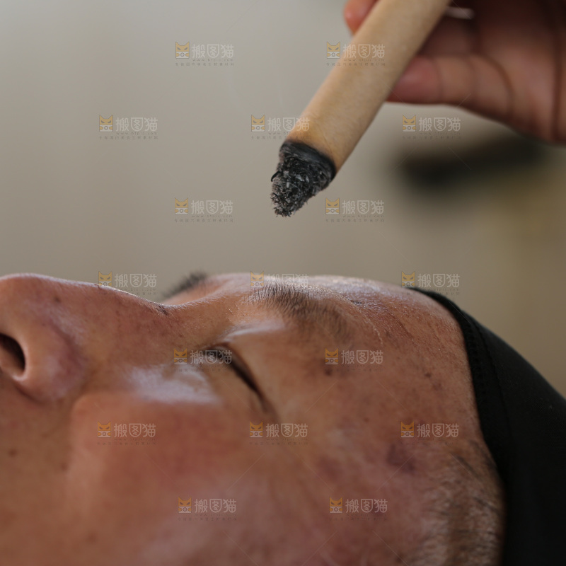 艾灸