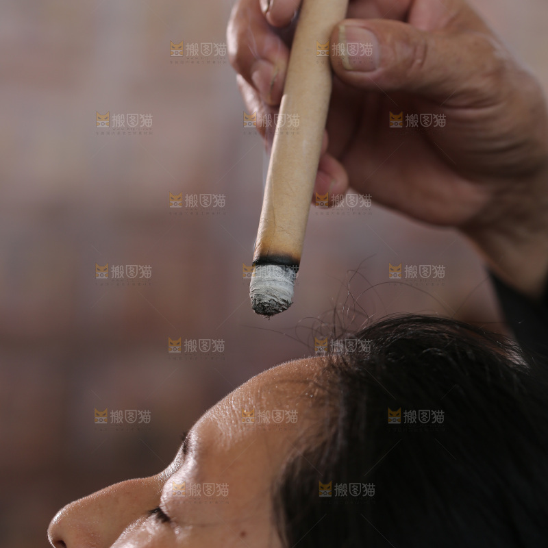 艾灸